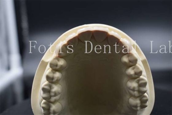 Carimbos de dentes artificiais de alta resistência Carimbos de porcelana dentista de aparência natural