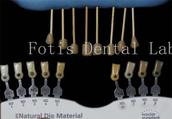 Durabilidade 0,3-0,5 mm Espessura Fabricações de laboratório dentário Fabricações falsas para dentes