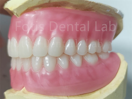 OEM Full Denture Acrílico Superior e Inferior Resistência a manchas Cor natural