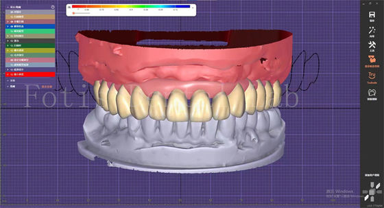 Serviço de Desenho de Dentes Dentários com Planejamento de Prótese e Desenhos de Implantes Orais