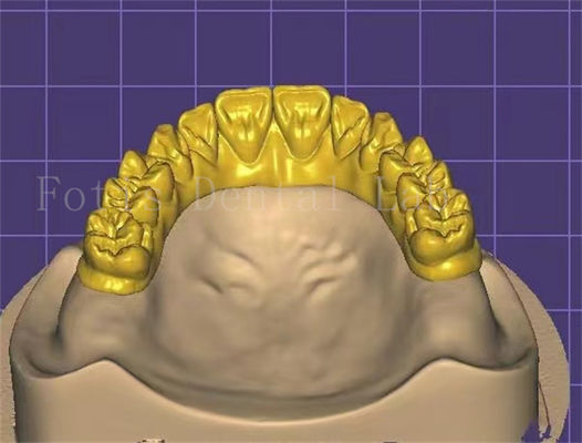 Personalização Design Dental Inovador Para Melhor Produtividade E Rentabilidade