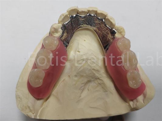 OEM Dentadura parcial removível flexível fácil de limpar / manter