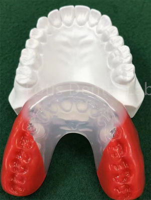 Aparelhos ortodônticos de grau médico para alinhamento perfeito dos dentes