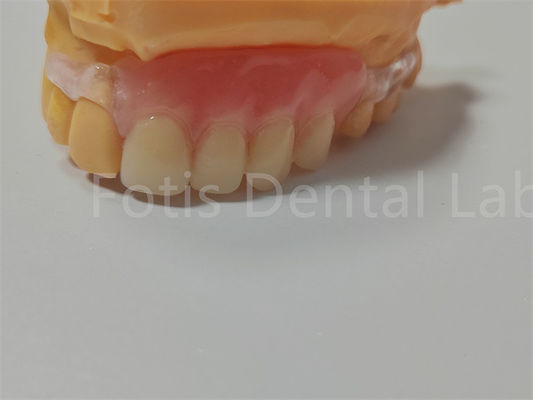 FDA/ISO Certificação TCS Valplast Dentes flexíveis Fácil de limpar Ajustar