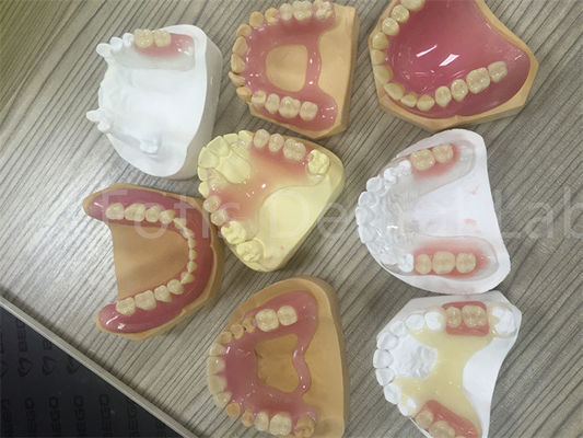 Flexível TCS Valplast Dentadura parcial removível fácil de ajustar