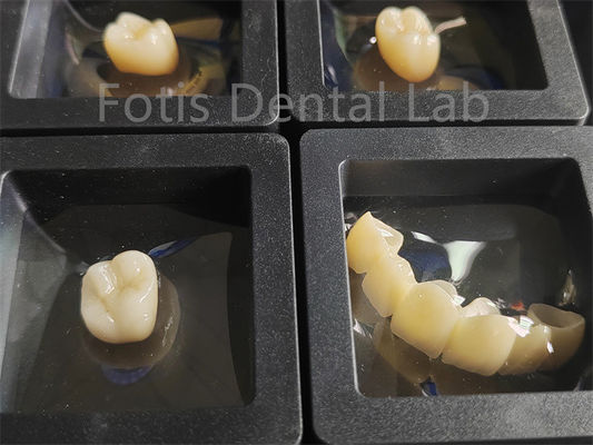 Restaurações dentárias Zirconia Multicamadas Resistência à fratura