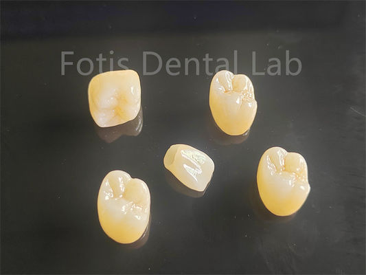 Apelo estético Porcelana completa em camadas de zircônio ideal para pontes de coroas