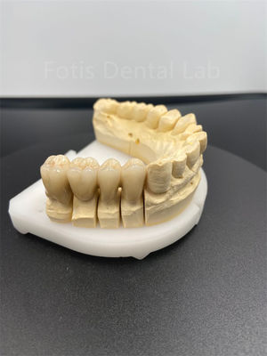 Boa performance Dental Zirconia Multilayer A solução cerâmica definitiva