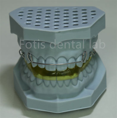 Laboratório Dental da China Retentor de fio lingual para expansão dentária