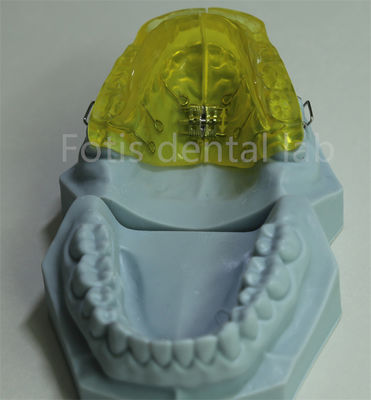 Retentor ortodôntico personalizável para laboratório dentário da China