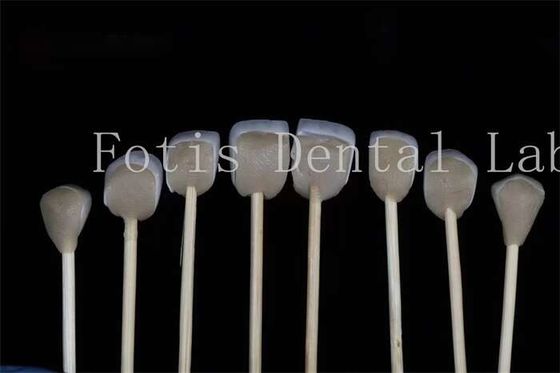 Veneers de laboratório dentário laminados personalizáveis Compatibilidade com várias preparações dentárias