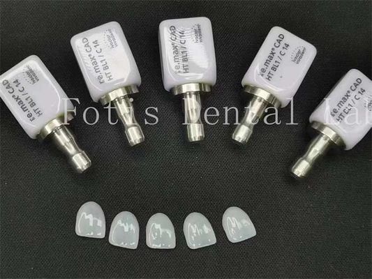 Veneers Dentários Artificiais de Alta Translucidez Ideal para a Bela Odontologia Cosmética