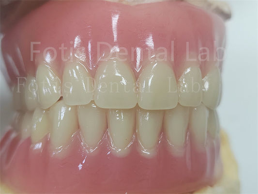 Conforto Dentadura de acrílico completo personalizado para prótese dentária precisa