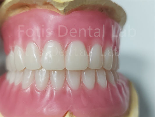 Duração de cor natural Full Acrylic Denture Desodorizado Personalização