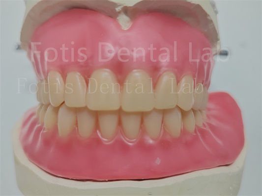 Prótese dentária acrílica personalizada com dentes Ivoclar fácil de usar