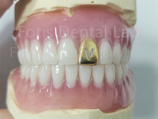 Prótese dental acrílica com dentes naturais