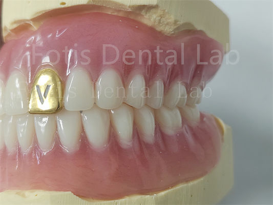 Dentes de acrílico de prótese completa personalizáveis resistentes a odores Conforto adequado