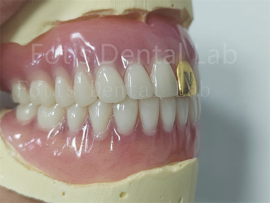 Estética Completa Prótese Dentária Acrílica Conjunto Personalizavel Adequado Fácil de Limpar