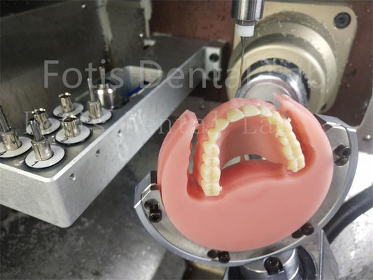 Ivoclar cor natural Full Acrylic Denture Conforto Prótese adequada com estética