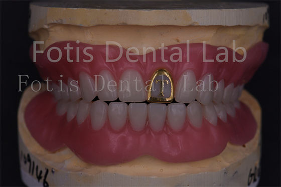 Técnicos Profissionais Dentes Completos de Acrílico Dentes Falsos Prótese de Precisão