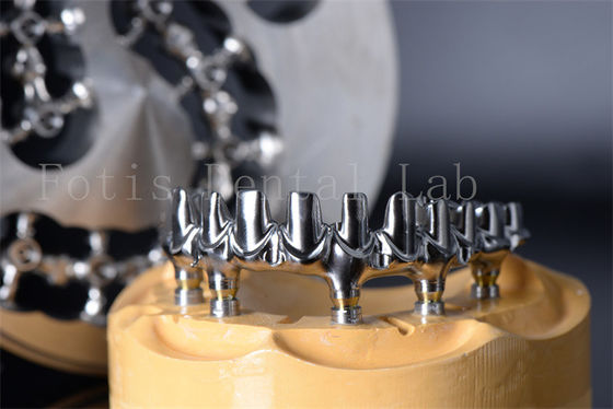 Minimamente invasivo Restaurar mastigar todos em 4 Todos em 6 Titânio ou Zirconia Dentes