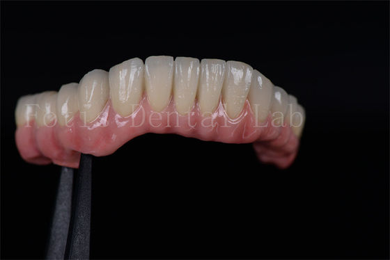 Alta taxa de sucesso todos em quatro todos em seis Zirconia Titânio implantes dentários personalizados