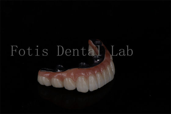 Sem limite de idade Acessível Todos em 6 Implantes de zircônio Fácil manutenção