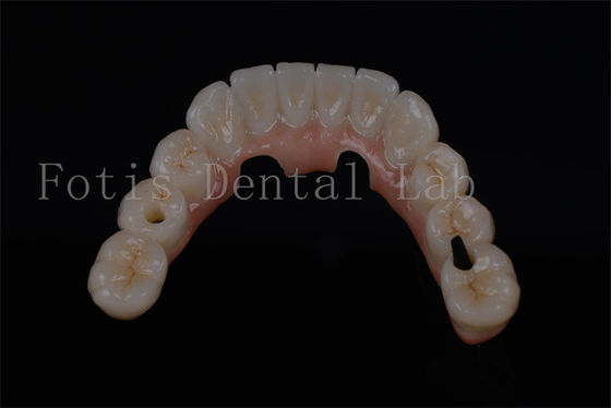 Natural olhando todos os quatro dentes em um dia para qualquer idade disponível
