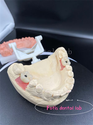 Coronas Dentárias de Peso Precíso de Boca Cheia Coronas Dentárias Falsas de Colocação Fácil
