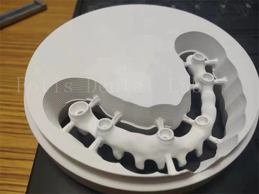 Implante dentário polido higiénico coroa de zircônio design personalizável