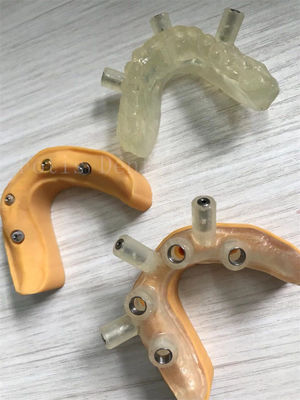 Coronas artificiais de dentes de alta resistência para implantes sem igual e durabilidade