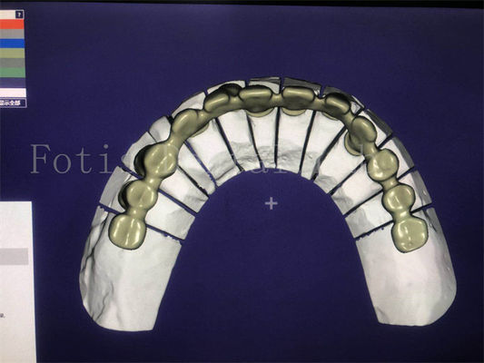 Serviço de Design Dental Eficaz e Confiável Superior e Competitivo