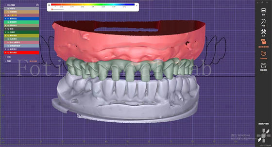 OEM Modelos de Boca Fabricante Serviço de Design Dental Com Construtor de Projeto Dental