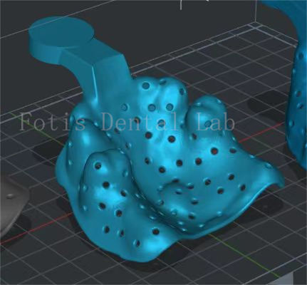 Serviço de Design Dental Personalizável Programa de Melhoria de Esmalte