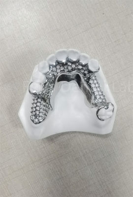 Alta estabilidade Dentes parciais flexíveis Facil limpeza Manutenção regular