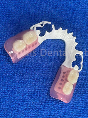 Prótese dental flexível ajustável estável confortável Prótese parcial imediata