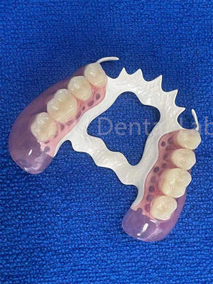 Resistente a manchas Parciais removíveis Dentes estáveis Substituir Dentes ausentes Prótese