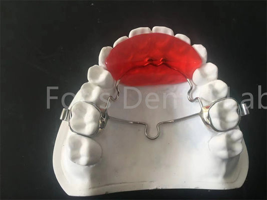 Retentor Ortodôntico Durável Expansor Uso Confortável e Prático