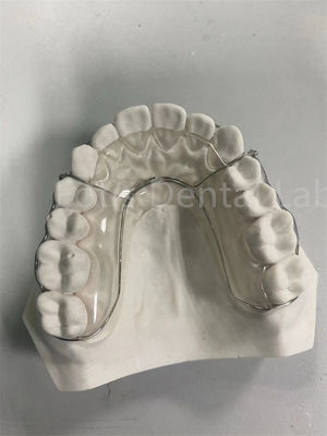 Solução de retenção de dentes durável e versátil