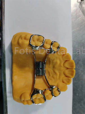 Expansor ortodôntico higiênico fácil de limpar Retentor dental de dentes Design ajustável