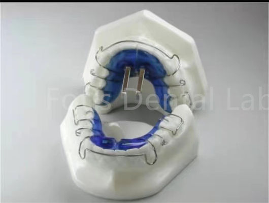 Tratamento Ortodôntico Retentor Expansor Para Alinhamento Preciso dos Dentes