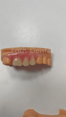 TCS durável Valplast parcial flexível Dentes flexíveis Resistentes a manchas