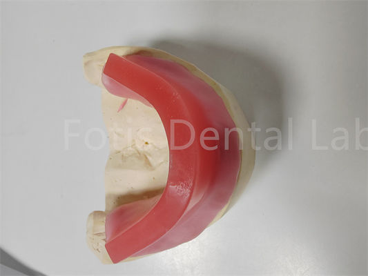 Rimes de mordida personalizadas para dentaduras Rimes de mordida dupla conjunto de relação de oclusão da mandíbula