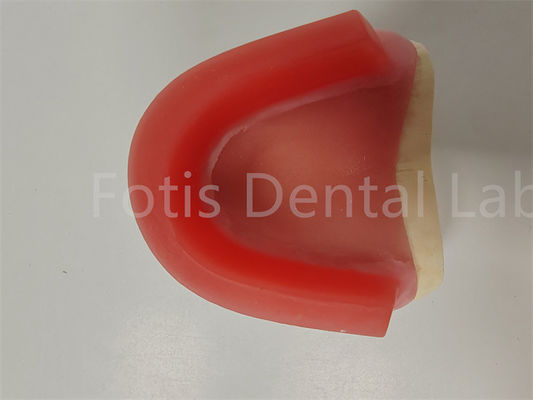 FDA aprovação mordida registro cera bordas dentaduras bordas oclusal