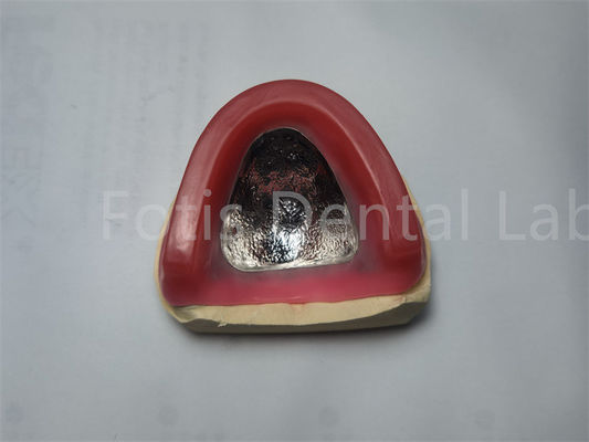 Dentes vermelhos Brilhantes Cerâmica Borda Oclusal Borda Conto Confortável