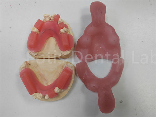 Vibrante Red mordida anéis Para Dentes Superiores ou Inferiores Finish Brilhante Limpos