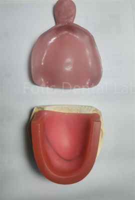 Conjunto de bandeja de branqueamento dentário higiénico para branqueamento dos dentes superiores ou inferiores