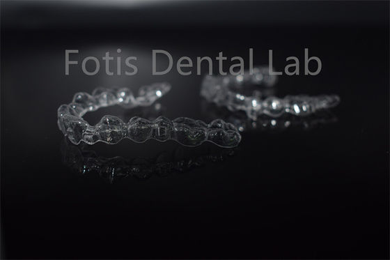 Dentes Removíveis Alinhadores Invisíveis Aparelhos Dentários Invisíveis Personalização