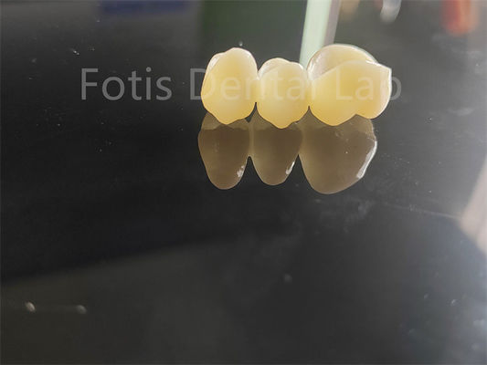 Indústria Dental Zirconia revestida com porcelana Solução duradoura
