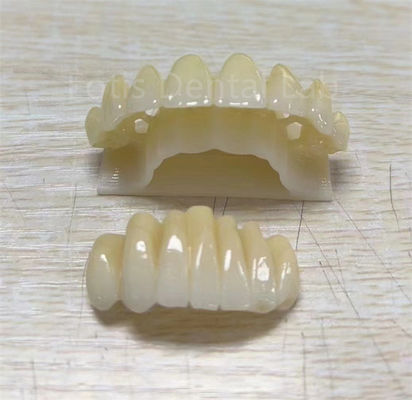 Produto multicamadas de zircônio de precisão para melhorar a resistência à fratura